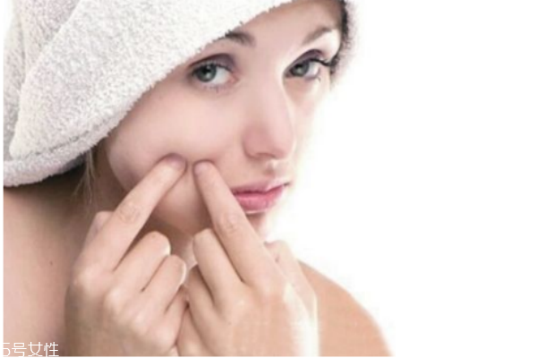 脸上的痘痘能不能挤,自己挤痘痘后怎么处理 脸上的痘痘能不能挤,自己挤痘痘后怎么处理