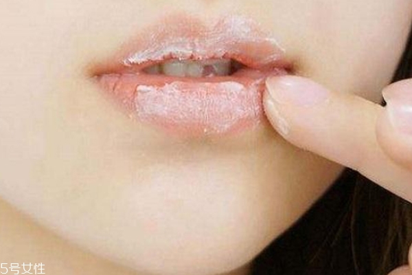 保护唇部的方法,唇部保养小知识