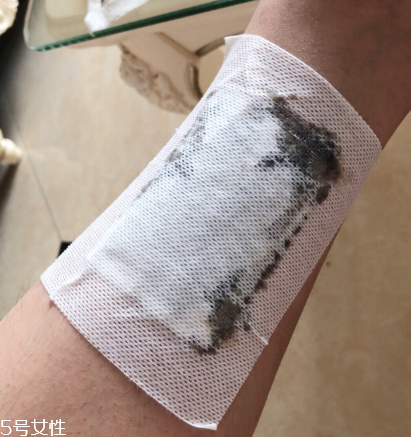 纳兰足贴去湿气的原理,纳兰足贴有用吗