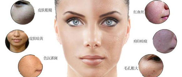 光子嫩肤后不能晒太阳吗,做完光子嫩肤后晒了太阳会怎样