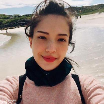 遗传性雀斑怎么内调理,遗传性雀斑怎么内调