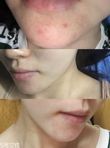 冻干粉的使用效果,冻干粉的使用效果图