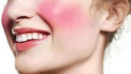 敏感肌肤形成的主要原因,敏感肌产生的原因