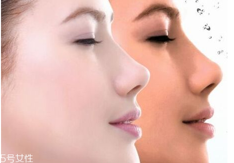 脸上特别黄是什么原因导致的?,面部发黄暗沉是什么原因 脸上特别黄是什么原因导致的?,面部发黄暗沉是什么原因