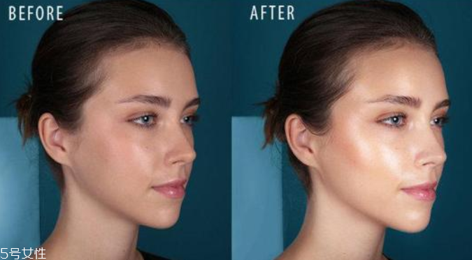 酵母提取物的护肤作用,酵母提取物在护肤品的功效和作用