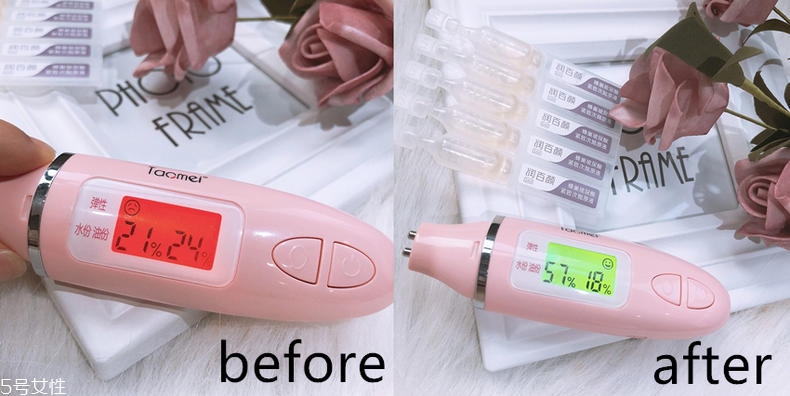 润百颜玻尿酸效果怎么样,颜百润玻尿酸怎么样