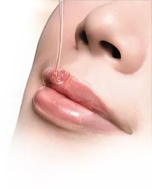 唇周暗沉如何改善,唇部暗沉如何改善