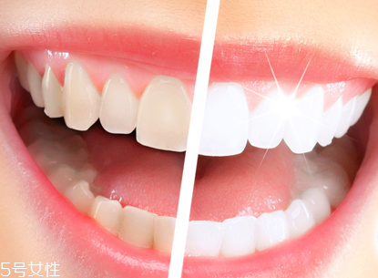 牙膏的种类,常用牙膏种类有哪些