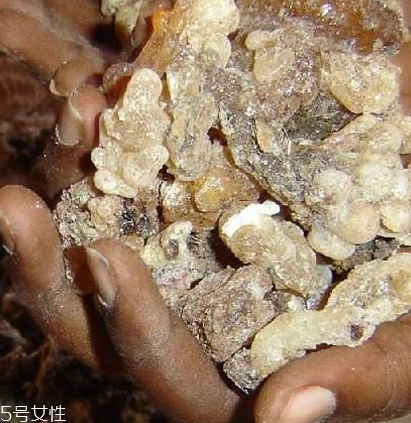 乳香纯露的功效及作用,乳香纯露的功效和作用点 乳香纯露的功效及作用,乳香纯露的功效和作用点