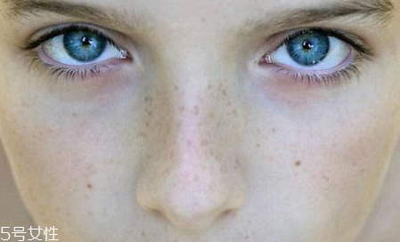 长黑头是什么原因造成的,皮肤长黑头是什么原因