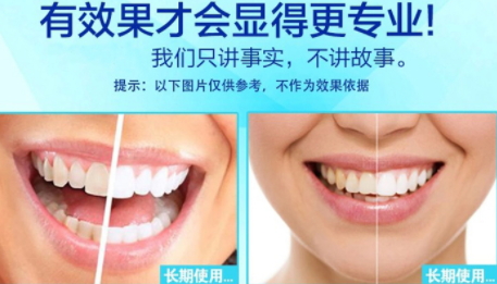 牙齿可以贴片美白吗,牙贴美白有用吗 牙齿可以贴片美白吗,牙贴美白有用吗