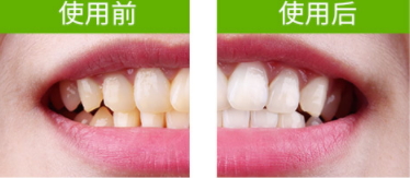 佳洁士牙贴用法,佳洁士牙贴使用