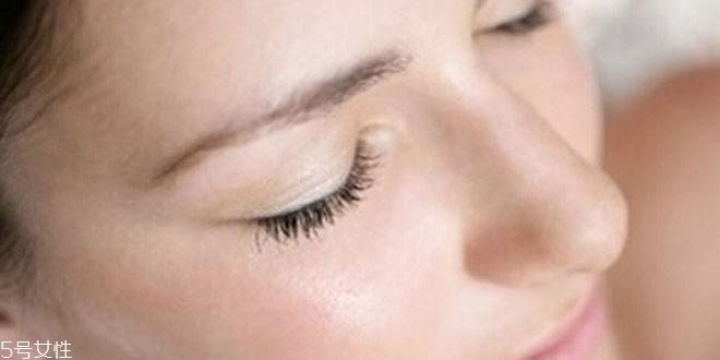 脸部螨虫是什么样子的,脸上有螨虫的征兆 脸部螨虫是什么样子的,脸上有螨虫的征兆