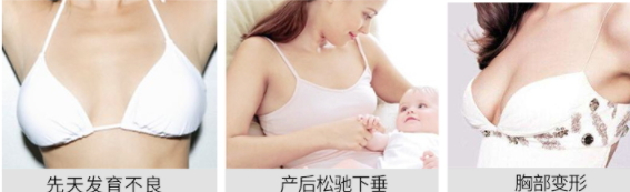 丰胸霜涂抹手法,丰胸霜按摩手法视频教程