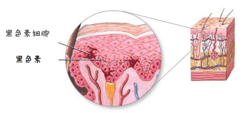 什么是黑色素沉着,怎么确定黑色素沉着是什么引起的