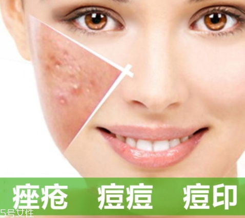 维a酸怎么建立耐受,a酸的副作用怎么缓解