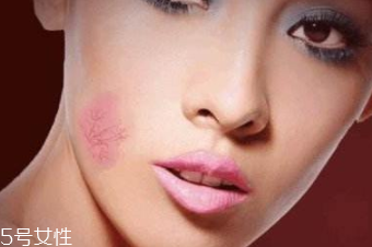 红血丝如何修复,红血丝如何修复小窍门