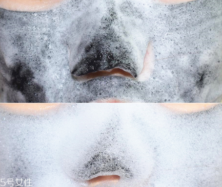 春雨的面膜怎么样,春雨面膜哪款好用