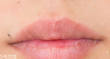兰芝唇膜使用的正确方法,兰芝唇膜怎么使用 兰芝唇膜使用的正确方法,兰芝唇膜怎么使用