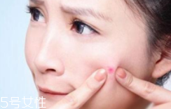 长痘原因有哪些,长痘的原因有哪些原因
