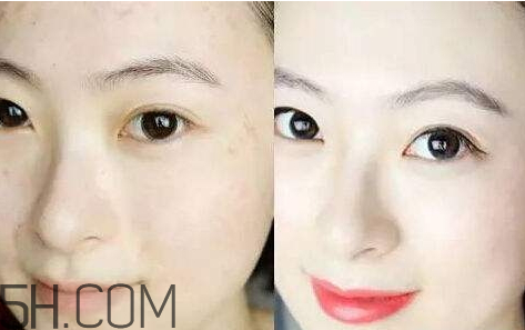 贝洛娜水光针效果怎么样,贝洛娜水光针效果 贝洛娜水光针效果怎么样,贝洛娜水光针效果