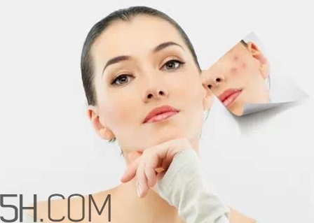 医院刷酸好还是自己刷酸好,自己刷酸和医院刷酸有什么区别