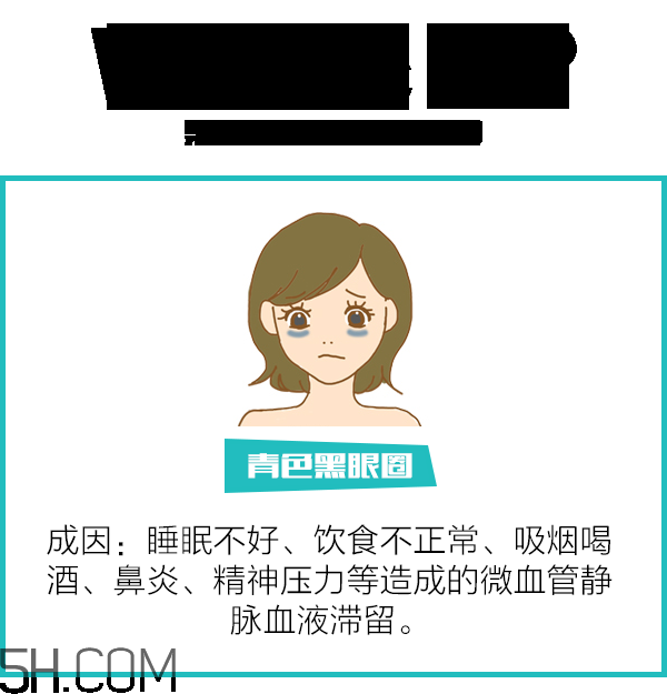 黑眼圈分类判断,怎么分辨黑眼圈的类型 黑眼圈分类判断,怎么分辨黑眼圈的类型