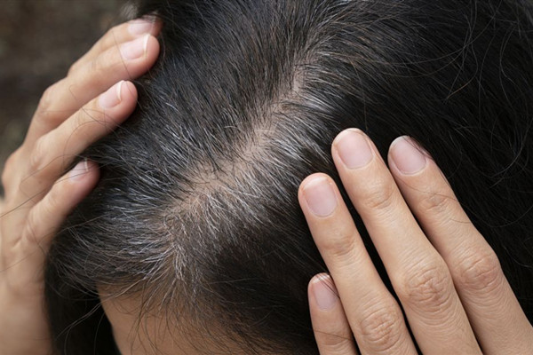 头皮植发手术可靠吗,毛发移植安全吗