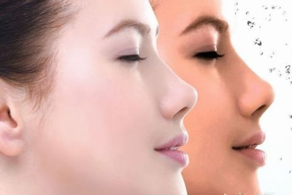 肉毒素除皱多久注射一次,注射肉毒素除皱能保持多久