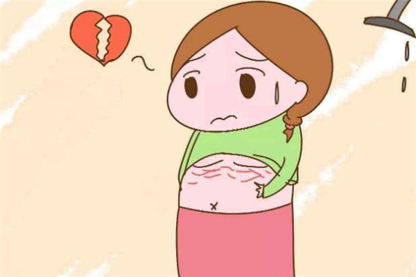 微针去妊娠纹效果怎么样,微针祛妊娠纹有效果吗