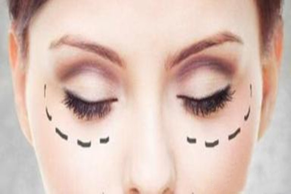 超声波去眼袋会打麻药吗,超声波去眼袋可以吗