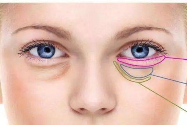 超声波去眼袋能维持多久,超声波去眼袋可以吗