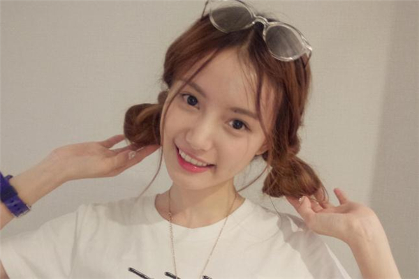 射频去黑眼圈有效果吗,射频去黑眼圈的后遗症