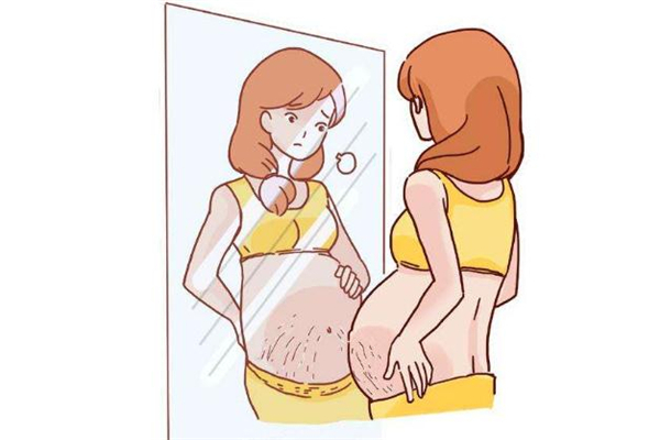 激光祛妊娠纹有效果吗,激光去妊娠纹效果好吗多少钱