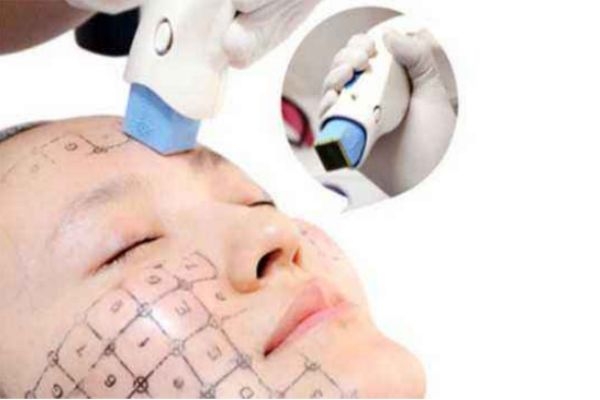 五代热玛吉和四代区别,热玛吉4代和5代