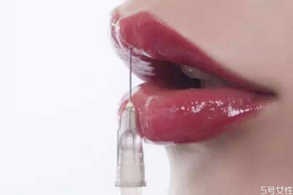 打玻尿酸有多痛,打玻尿酸好痛