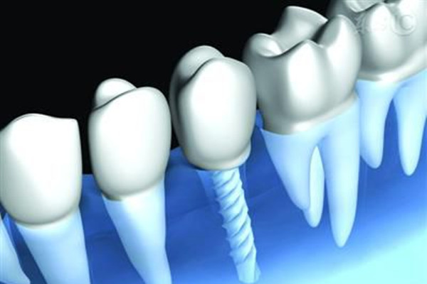 种植牙牙龈肿了怎么办,种植的牙齿牙龈肿怎么办