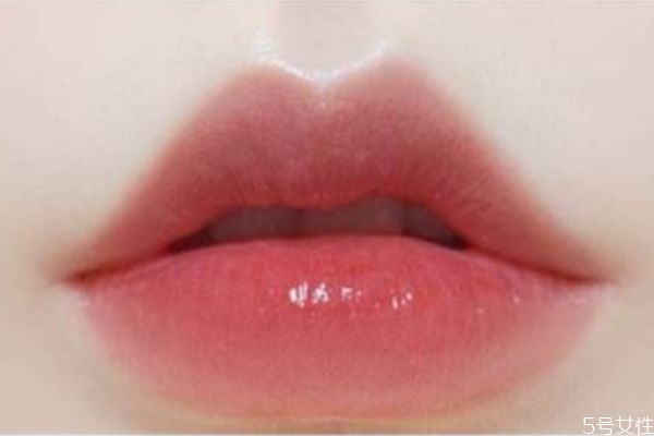 打完嘟嘟唇多久定型,嘟嘟唇打几次可以定型