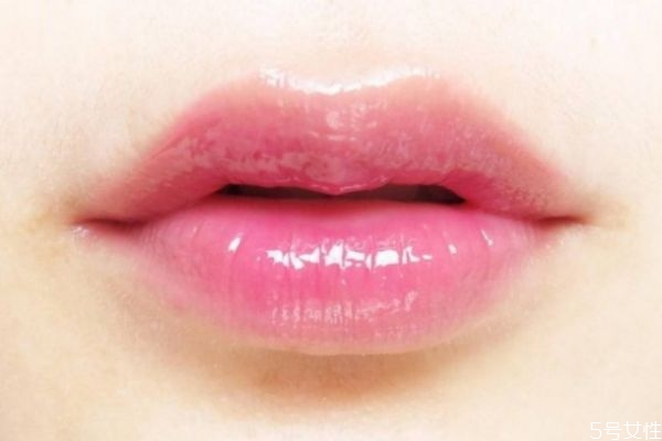 玻尿酸嘟嘟唇多久恢复自然,嘟嘟唇打完几天最自然