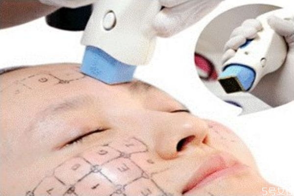 热玛吉一次多少钱多久做一次,热玛吉多少钱一次啊