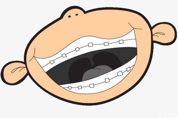 美容冠矫正牙齿一般多少钱,美容冠矫正多少钱一颗