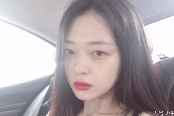 玻尿酸打下巴会硬几天,玻尿酸打下巴会硬几天可以化妆吗 玻尿酸打下巴会硬几天,玻尿酸打下巴会硬几天可以化妆吗