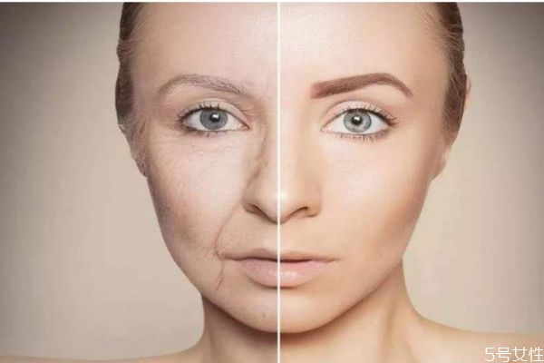 果酸换肤副作用是什么,果酸换肤真的有效果吗,有副作用吗 果酸换肤副作用是什么,果酸换肤真的有效果吗,有副作用吗