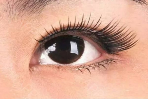 上睑提肌作用是什么,上睑提肌和提上睑肌