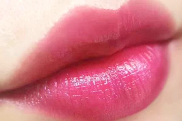 水晶唇能维持几年,水晶唇几天恢复自然