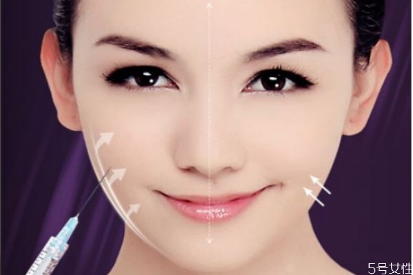 瘦脸针的打法和画点,瘦脸针在哪里打