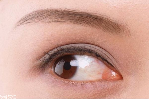 开眼角需要注意的问题,建议开眼角吗 开眼角需要注意的问题,建议开眼角吗
