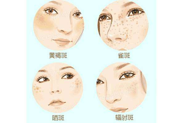 光电祛斑有没有副作用,光子祛斑对皮肤有伤害吗