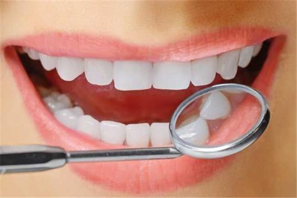 如何预防牙结石的形成,防止牙结石