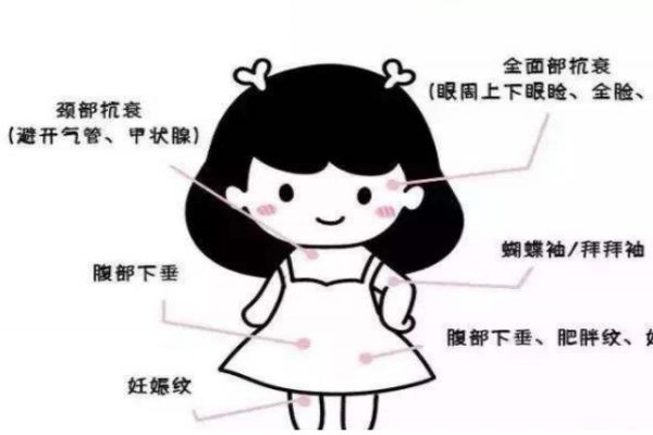 热玛吉多久做一次呢?,热玛吉要多久做一次